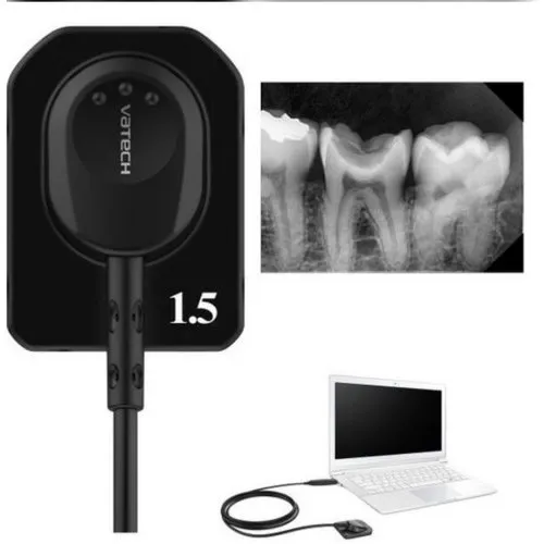 Vatech RVG EZ Sensor Classic Size 1.5: The Ultimate Solution for High-Quality Digital Radiography AVAILABLE AT CHOUDHARY DENTAL DEPOT 3 vatech dental rvg sensor 500x500 1