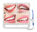 "Appledent Dental Intra Oral Camera with 17 inch LED Monitor – CE Certified Dental Imaging Equipment"